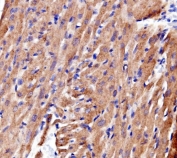 IHC staining of FFPE rat heart tissue with ACTN2 antibody. HIER: boil tissue sections in pH8 EDTA for 20 min and allow to cool before testing.