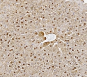 IHC staining of FFPE mouse liver tissue with Alanine aminotransferase 1 antibody. HIER: boil tissue sections in pH8 EDTA for 20 min and allow to cool before testing.