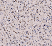 IHC staining of FFPE mouse brain tissue with 5HT1B antibody. HIER: boil tissue sections in pH8 EDTA for 20 min and allow to cool before testing.