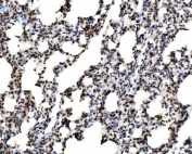 IHC staining of FFPE rat lung tissue with SPHK1 antibody. HIER: boil tissue sections in pH8 EDTA for 20 min and allow to cool before testing.