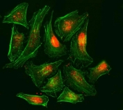 Immunofluorescent staining of FFPE human HeLa cells with Replication Protein A2 antibody (Dylight 594-conjugated secondary, red) and Phalloidin-iFluor 488 conjugate (green). HIER: steam section in pH6 citrate buffer for 20 min.