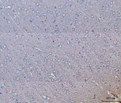 IHC staining of FFPE rat brain tissue with GNB3 antibody. HIER: boil tissue sections in pH8 EDTA for 20 min and allow to cool before testing.