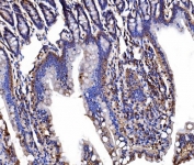 IHC staining of FFPE rat colon tissue with LSR antibody. HIER: boil tissue sections in pH8 EDTA for 20 min and allow to cool before testing.
