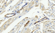 IHC staining of FFPE rat heart tissue with MT-ND5 antibody. HIER: boil tissue sections in pH8 EDTA for 20 min and allow to cool before testing.
