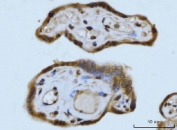 IHC staining of FFPE human placental tissue with Synaptonemal Complex Protein 3 antibody. HIER: boil tissue sections in pH8 EDTA for 20 min and allow to cool before testing.