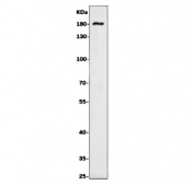 Western blot testing of human Caco-2 cell lysate with SLC12A2 antibody. Expected molecular weight: 130-180 kDa depending on glycosylation level.