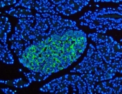 Immunofluorescent staining of FFPE rat pancreas tissue with Synaptophysin antibody. HIER: boil tissue sections in pH8 EDTA for 20 min and allow to cool before testing.