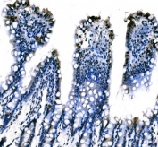 IHC staining of FFPE rat colon tissue with Splicing factor 1 antibody. HIER: boil tissue sections in pH8 EDTA for 20 min and allow to cool before testing.
