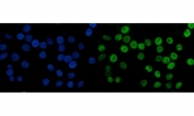 Immunofluorescent staining of FFPE human Caco-2 cells with MCM6 antibody (green) and DAPI nuclear stain (blue). HIER: steam section in pH6 citrate buffer for 20 min.