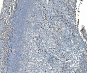 IHC staining of FFPE human tonsil tissue with TDRD11 antibody. HIER: boil tissue sections in pH8 EDTA for 20 min and allow to cool before testing.