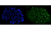 Immunofluorescent staining of FFPE human A431 cells with Nuclear factor 1 B-type antibody (green) and DAPI nuclear stain (blue). HIER: steam section in pH6 citrate buffer for 20 min.