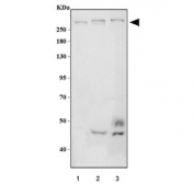 Western blot testing of 1) human HeLa, 2) rat brain and 3) mouse brain tissue lysate with Neurofibromin antibody. Predicted molecular weight ~319 kDa.