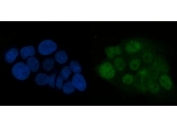 Immunofluorescent staining of FFPE human A431 cells with ATR antibody (green) and DAPI nuclear stain (blue). HIER: steam section in pH6 citrate buffer for 20 min.