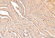 IHC staining of FFPE mouse heart tissue with PLB antibody, HRP-secondary and DAB substrate. HIER: boil tissue sections in pH8 EDTA for 20 min and allow to cool before testing.
