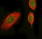 Immunofluorescent staining of FFPE human SiHa cells with Prospero homeobox protein 1 antibody (green) and Alpha Tubulin mAb (red). HIER: steam section in pH6 citrate buffer for 20 min.