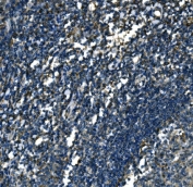 IHC staining of FFPE human tonsil tissue with ATP6V1A antibody. HIER: boil tissue sections in pH8 EDTA for 20 min and allow to cool before testing.
