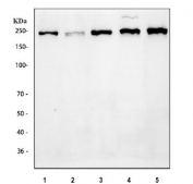 Western blot testing of 1) human HepG2, 2) human A549, 3) human MCF7, 4) rat C6 and 5) mouse NIH 3T3 cell lysate with Bromodomain-containing protein 4 antibody. Predicted molecular weight ~156 kDa (long form, can be observed at 200+ kDa) and ~81 kDa (short form).