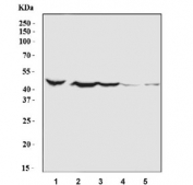 Western blot testing of human 1) HepG2, 2) Caco-2, 3) PANC-1, 4) K562 and 5) RT4 cell lysate with Caspase-8 antibody. Predicted molecular weight: ~55 kDa (pro), ~40 kDa (large + small subunit), ~20 kDa (large subunit).