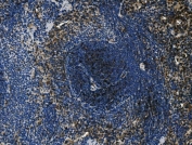 IHC staining of FFPE rat spleen tissue with Cd4 antibody. HIER: boil tissue sections in pH8 EDTA for 20 min and allow to cool before testing.