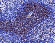 IHC staining of FFPE rat spleen tissue with Cd27 antibody. HIER: boil tissue sections in pH8 EDTA for 20 min and allow to cool before testing.
