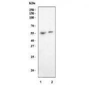 Western blot testing of 1) rat stomach and 2) mouse stomach tissue lysate with AMCase antibody. Predicted molecular weight ~52 kDa.