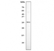 Western blot testing of human U-2 OS cell lysate with FGF11 antibody. Predicted molecular weight ~25 kDa.