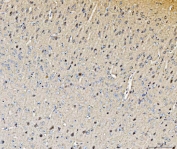 IHC staining of FFPE mouse brain tissue with Histidine decarboxylase antibody. HIER: boil tissue sections in pH8 EDTA for 20 min and allow to cool before testing.