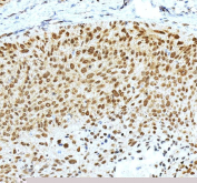 IHC staining of FFPE rat stomach tissue with Krueppel-like factor 4 antibody. HIER: boil tissue sections in pH8 EDTA for 20 min and allow to cool before testing.