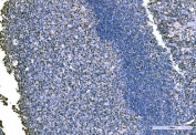 IHC staining of FFPE human tonsil tissue with Importin subunit alpha-1 antibody. HIER: boil tissue sections in pH8 EDTA for 20 min and allow to cool before testing.