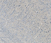 IHC staining of FFPE rat brain tissue with NEDD4 antibody. HIER: boil tissue sections in pH8 EDTA for 20 min and allow to cool before testing.