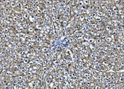 IHC staining of FFPE rat liver with Egf receptor antibody. HIER: boil tissue sections in pH8 EDTA for 20 min and allow to cool before testing.