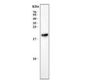 Western blot testing of mouse eye lysate with Aanat antibody. Predicted molecular weight ~23 kDa.