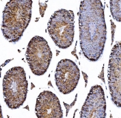 IHC staining of FFPE mouse kidney tissue with HGF-regulated tyrosine kinase substrate antibody. HIER: boil tissue sections in pH8 EDTA for 20 min and allow to cool before testing.