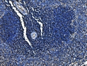 IHC staining of FFPE rat spleen tissue with Cd6 antibody. HIER: boil tissue sections in pH8 EDTA for 20 min and allow to cool before testing.