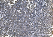 IHC staining of FFPE human tonsil tissue with H1F0 antibody. HIER: boil tissue sections in pH8 EDTA for 20 min and allow to cool before testing.