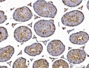 IHC staining of FFPE mouse testis tissue with AHSA1 antibody. HIER: boil tissue sections in pH8 EDTA for 20 min and allow to cool before testing.