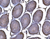 IHC staining of FFPE rat testis tissue with AHSA1 antibody. HIER: boil tissue sections in pH8 EDTA for 20 min and allow to cool before testing.