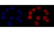 Immunofluorescent staining of FFPE human Caco-2 cells with MSH2 antibody (red) and DAPI nuclear stain (blue). HIER: steam section in pH6 citrate buffer for 20 min.