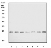 Western blot testing of 1) rat brain, 2) rat liver, 3) rat kidney, 4) rat pancreas, 5) mouse brain, 6) mouse liver and 7) mouse kidney tissue cell lysate with Proteasome 20S beta 7 antibody. Predicted molecular weight ~30 kDa.