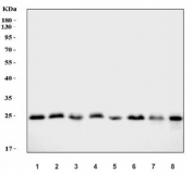 Western blot testing of human 1) HeLa, 2) PC-3, 3) MCF7, 4) Caco-2, 5) 293T, 6) HepG2, 7) HL60 and 8) A549 cell lysate with Proteasome 20S beta 7 antibody. Predicted molecular weight ~30 kDa.