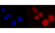 Immunofluorescent staining of FFPE human Caco-2 cells with Poly(rC)-binding protein 2 antibody (red) and DAPI nuclear stain (blue). HIER: steam section in pH6 citrate buffer for 20 min.