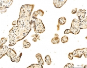 IHC staining of FFPE human placental tissue with p53 binding protein 1 antibody. HIER: boil tissue sections in pH8 EDTA for 20 min and allow to cool before testing.