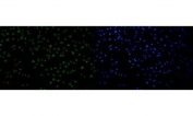 Immunofluorescent staining of FFPE human HeLa cells with p53 binding protein 1 antibody (green) and DAPI nuclear stain (blue). HIER: steam section in pH6 citrate buffer for 20 min.