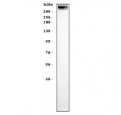Western blot testing of human U-2 OS cells with p53 binding protein 1 antibody. Predicted molecular weight: ~214 kDa but may be observed at up to ~450 kDa.
