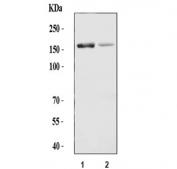 Western blot testing of 1) rat liver and 2) mouse liver tissue lysate with ADAMTS13 antibody. Predicted molecular weight ~154 kDa.