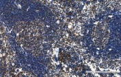 IHC staining of FFPE mouse spleen tissue with Blr1 antibody. HIER: boil tissue sections in pH8 EDTA for 20 min and allow to cool before testing.