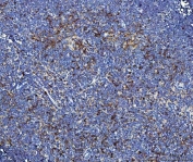 IHC staining of FFPE rat thymus tissue with Il2r alpha antibody. HIER: boil tissue sections in pH8 EDTA for 20 min and allow to cool before testing.