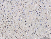 IHC staining of FFPE rat brain tissue with RGS12 antibody. HIER: boil tissue sections in pH8 EDTA for 20 min and allow to cool before testing.