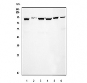 Western blot testing of 1) human Caco-2, 2) human K562, 3) A549, 4) A549, 5) mouse testis and 6) mouse lung tissue lysate with KPNB1 antibody. Predicted molecular weight: ~97 kDa.