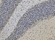 IHC staining of FFPE rat brain tissue with Ataxin 1 antibody. HIER: boil tissue sections in pH8 EDTA for 20 min and allow to cool before testing.